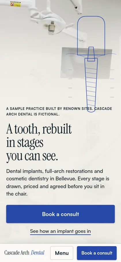 The same Cascade Arch Dental homepage on a phone